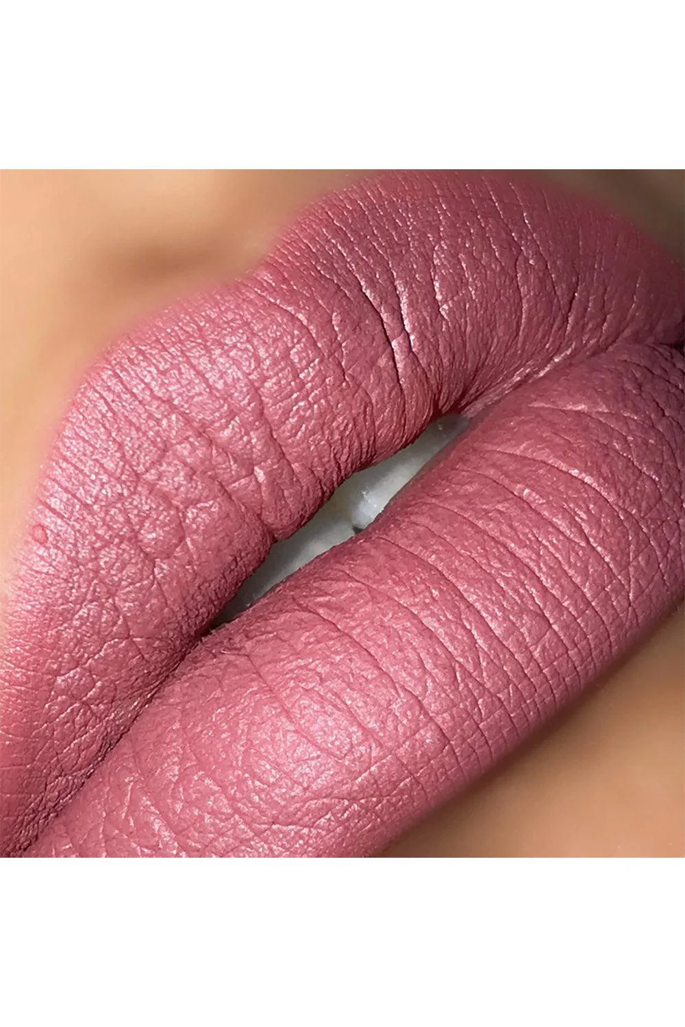 Lip Potion [CHARM] - Image 3